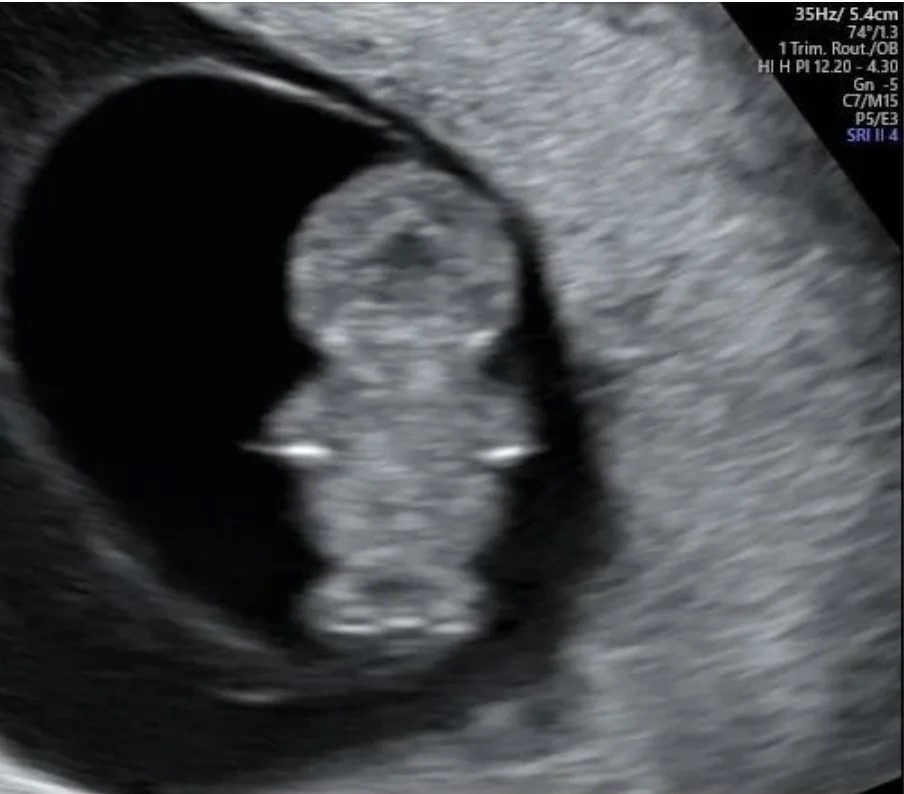 baby's sonogram  future  South Park character.jpg