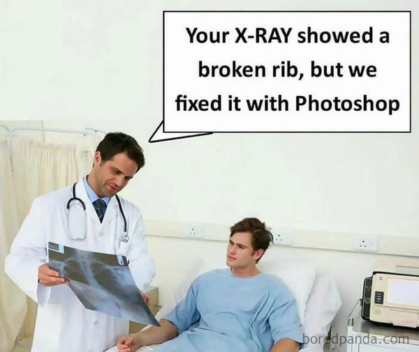 broken rib fixed with photoshop.jpg
