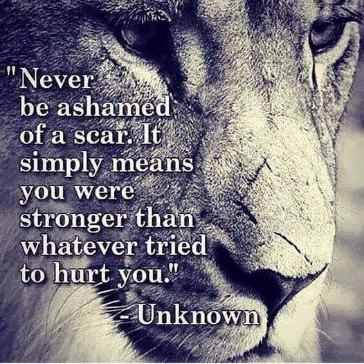 never be ashamed of a scar.jpg