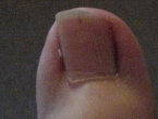 Toe1.gif