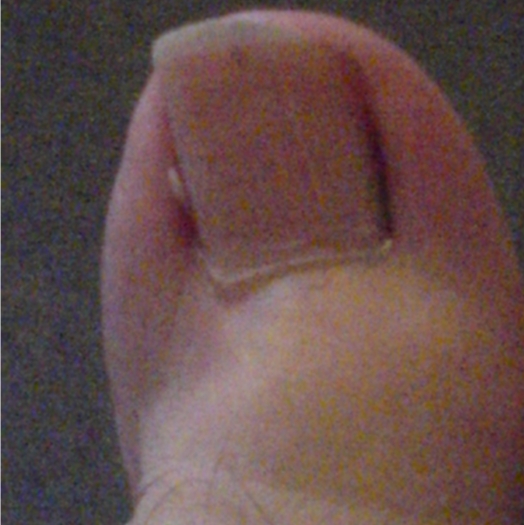 Toe2.jpg