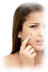 pimple.jpg