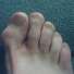 toe.jpg