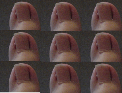 Toe2.gif